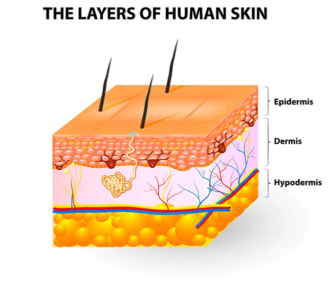 epidermis layers